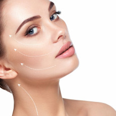 Fadenlifting München